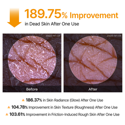 Peel Shot Keratin Care Kojic Acid Turmeric Spray
